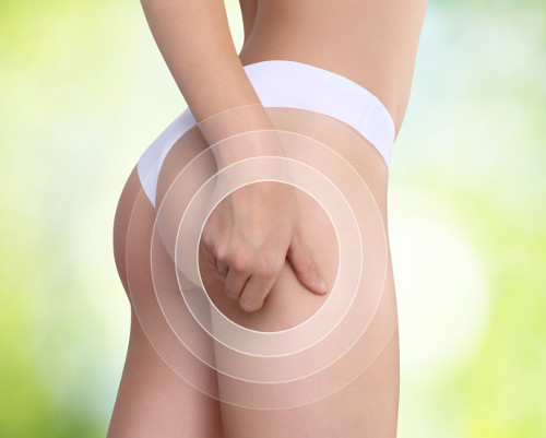 MesoCellulite