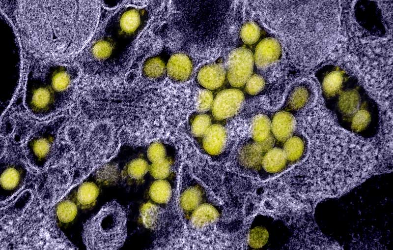 Lire la suite à propos de l’article Disease detectives track an invisible virus