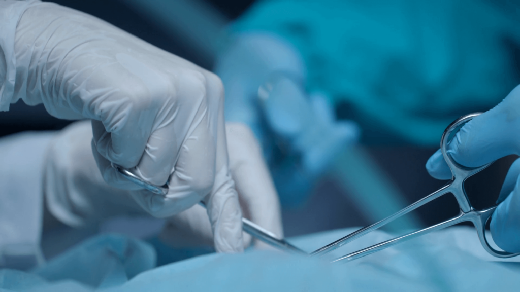 Types Of Tenotomy Scissors