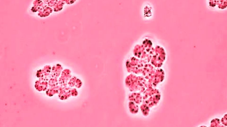 Italiano Dunaliella Salina Sistematica Etimologia Habitat Coltivazione