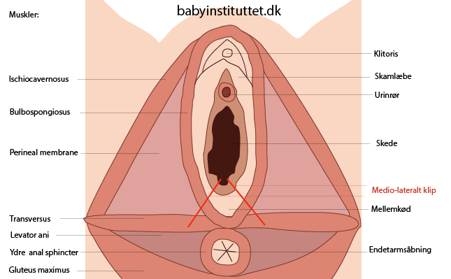 episiotomi vist med illustration