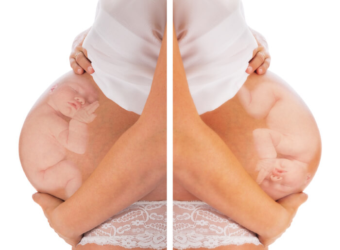Fosterstilling - Gravid mave med baby i hovedstilling og UK