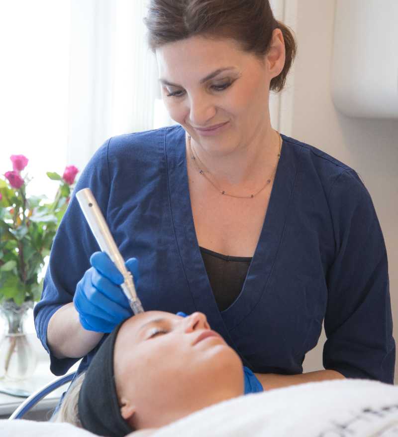 micro needling ansigtsbehandling beautysolution