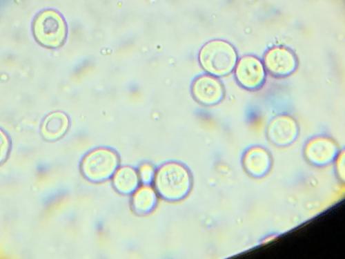 Yeast in the microscope