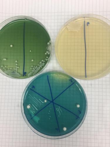 Selective media for microbial analysis