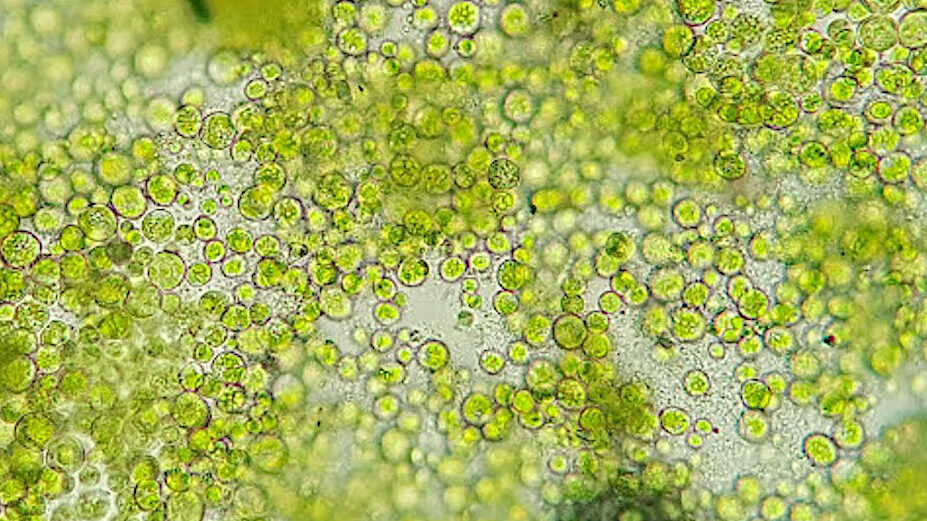 Fascinante Naturaleza: Historia de un alga llamada Trebouxia.