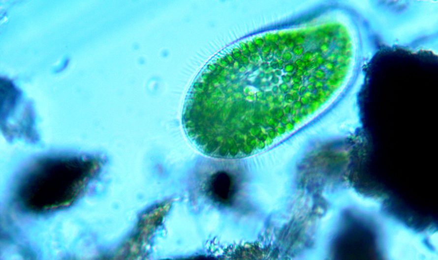 Fascinante Naturaleza: Paramecium bursaria.