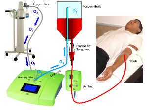 alternative cancer treatments