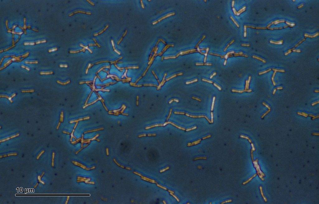 Lactobacillus acidophilus bakterier i tjocktarmen i mikroskåp. Mikroorganismer i vår tjocktarm styr vårt beteende.