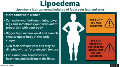 What is lipoedema? Graphic with explanation of symptoms from the NHS