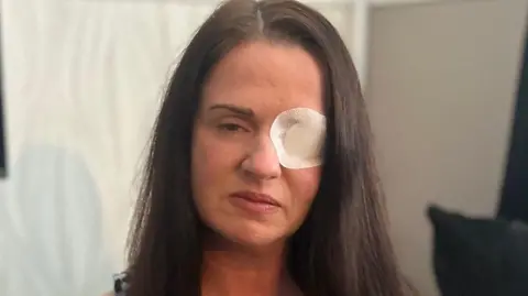 BBC Kaylie Bailey, a woman in her mid 30s with long dark straight hair, a white eye patch over her left eye, sitting on a couch.