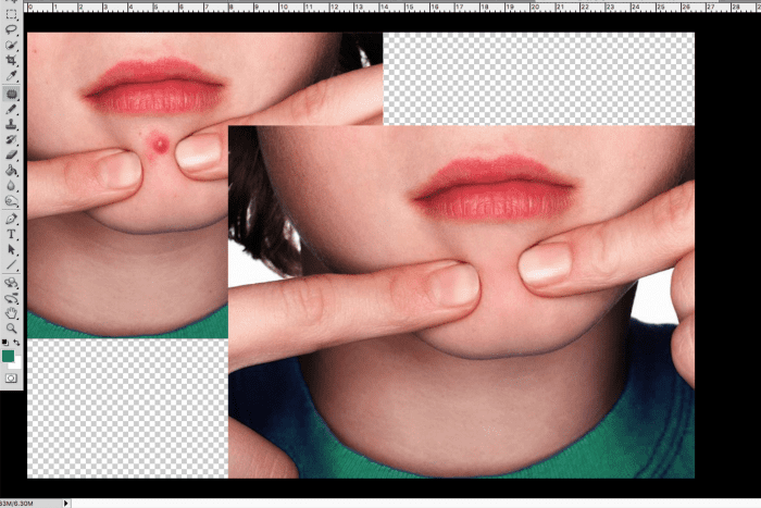 Rich result on Google when search for Blemish - Image retouch services in Adobe photoshop