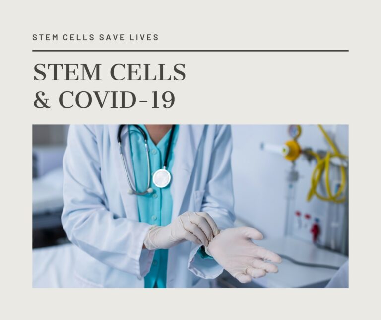 Covid-19 patients are treated with stem cells