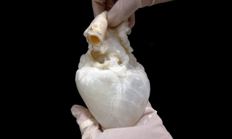 Ghost hearts could relieve the shortage of donor organs