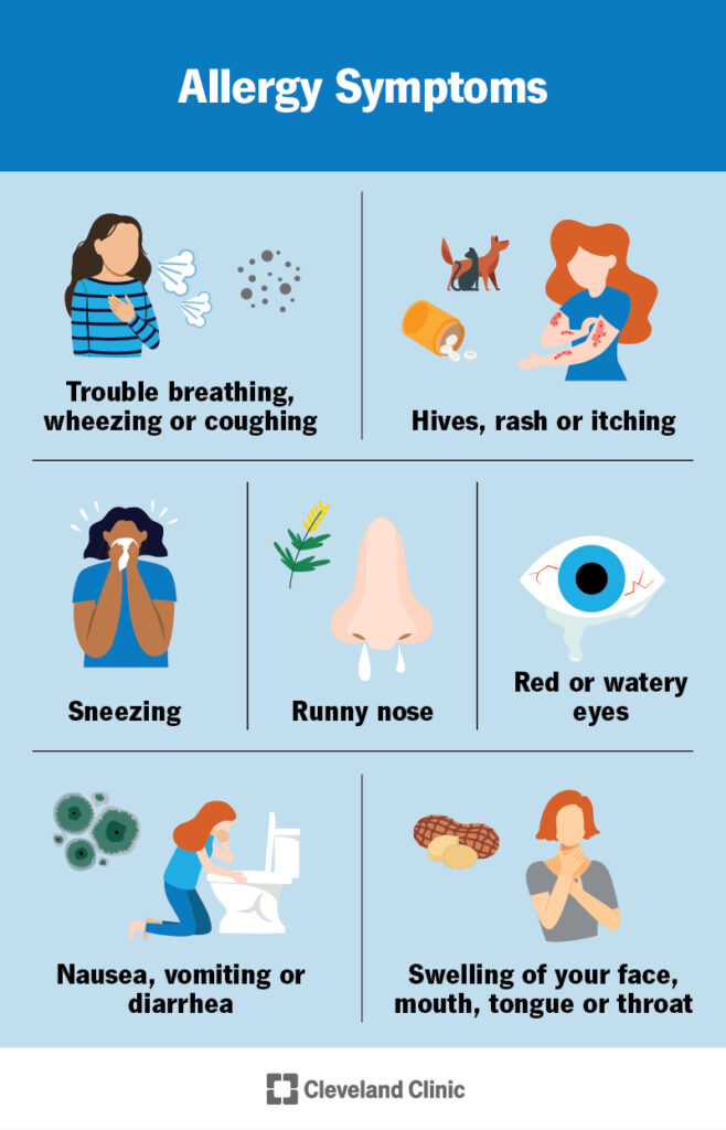 Spring allergies Chantilly Pdiatrics