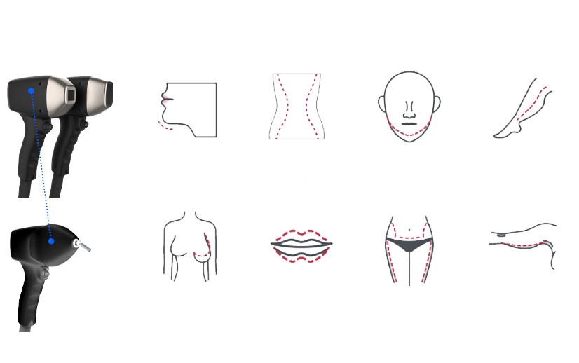 Behandlingsområder med Laser 3D Pro