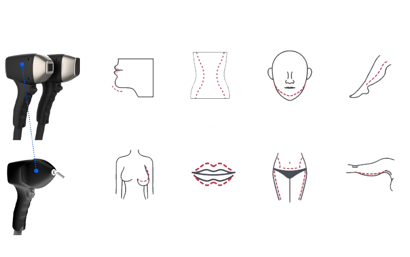 Behandlingsområder med Laser 4D Pro MAX