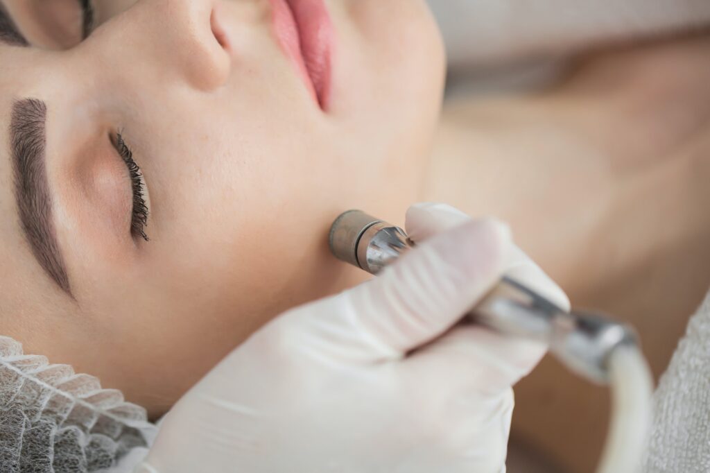 Diamond microdermabrasion. Woman during a microdermabrasion treatment in beauty salon