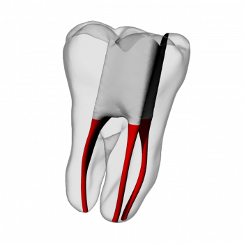 Molar – Accessed, Basic, Clear