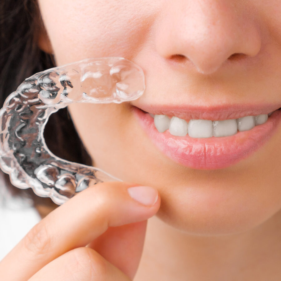 Estetisk tannbehandling usynlig tannregulering_1-1
