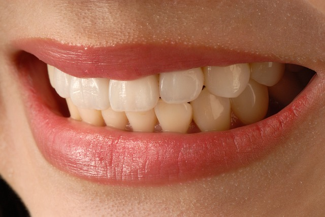 Veneers kan blant annet skjule mellomrom mellom tenner 