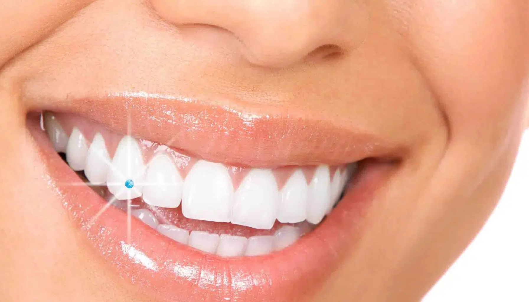 En kvinne som smiler med en blå diamantgrill på tannen, og de hvite tennene glitrer.