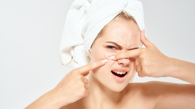 Les solutions naturelles pour lutter contre l'acné