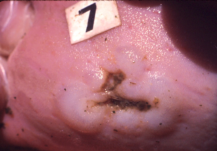 Ulceration under avläkning
