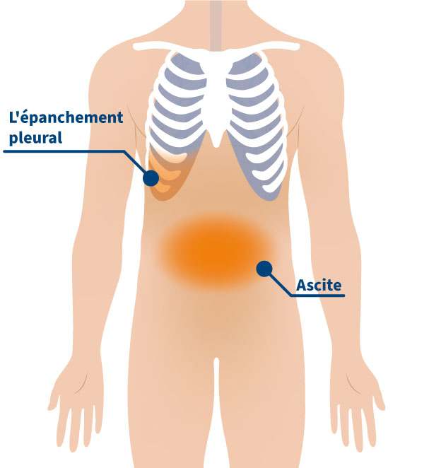 Maladies Ewimed