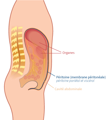 Ascite Ewimed