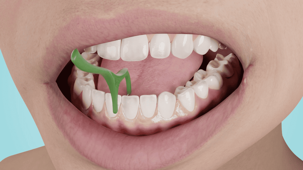 Tepe Interdental brush (IDB) Explainer