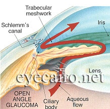 علاج الجلوكوما مفتوحة الزاوبة فى عيادة د أحمد خليل