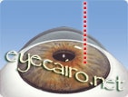 Femtosecond laser applied before rings implantation at Dr Khalil Eye CLinic in Cairo, Egypt