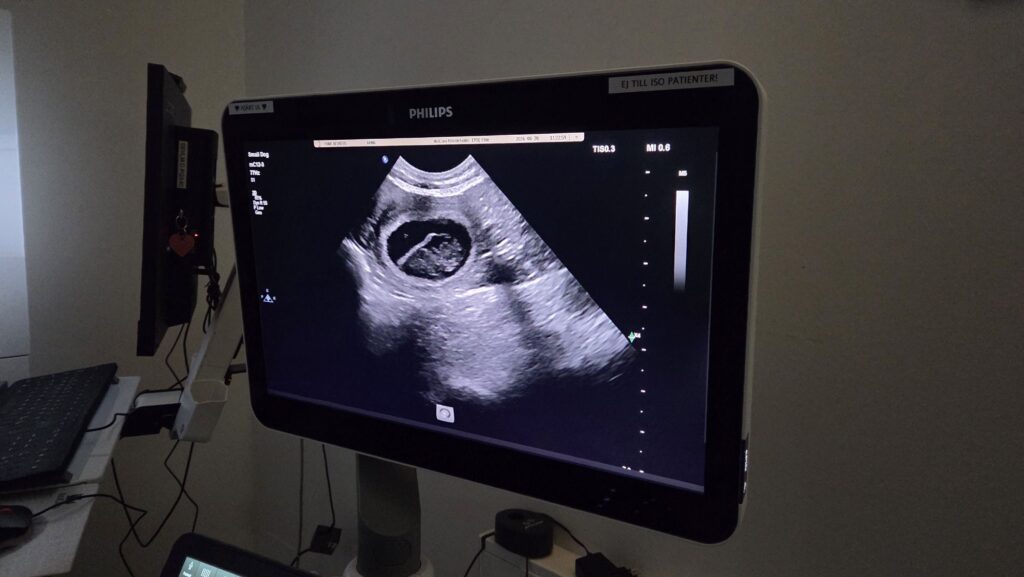 Äntligen vet vi – Fame är dräktig! ❤️