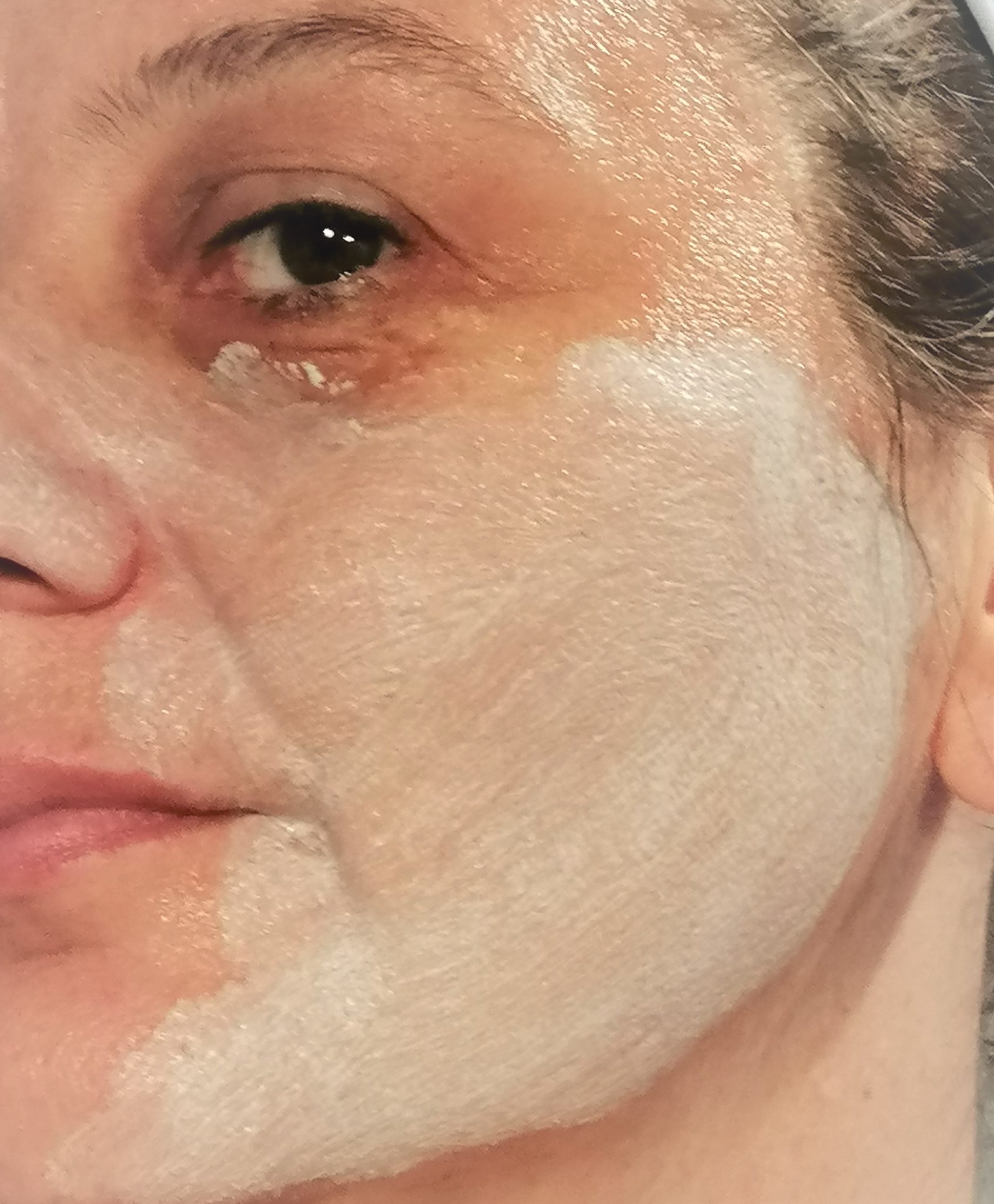 derma pureté peeling texture sur visage humide