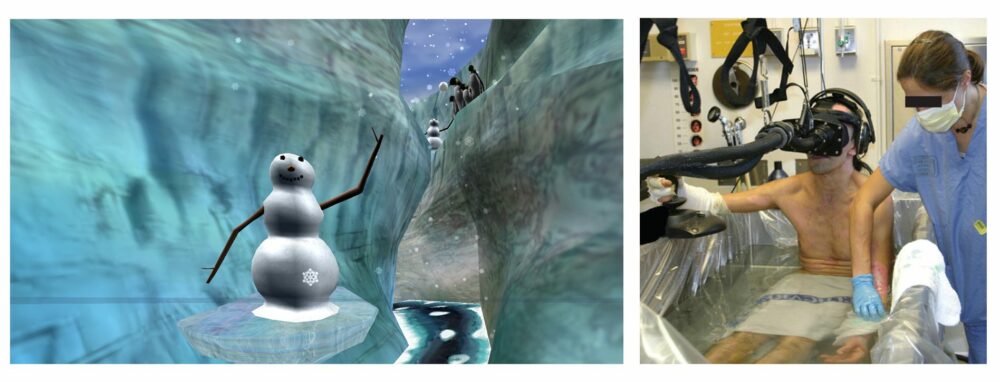 The SnowWorld virtual reality world was created to reduce the pain of patients with severe burns.