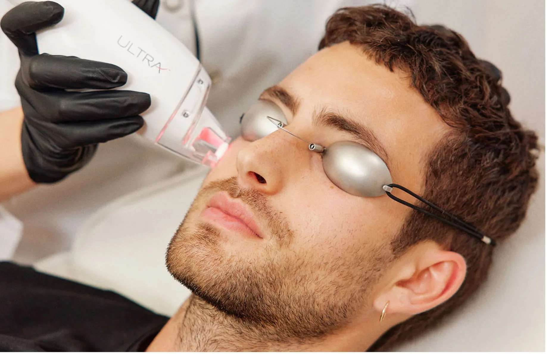 BABY FACE LASE MD ULTRA D THOMAS CLINIC