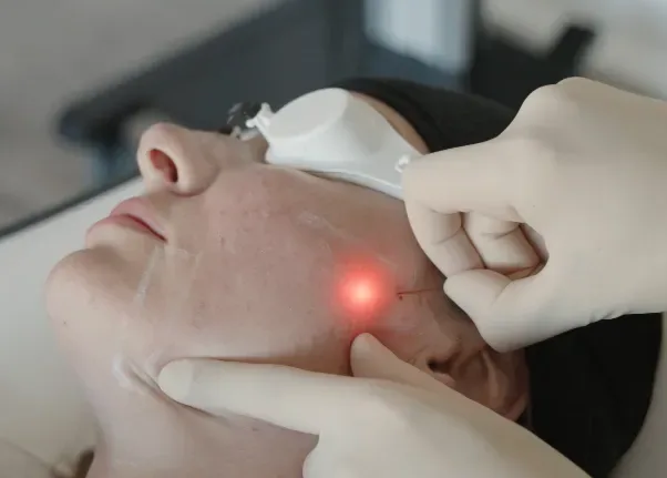 Endolift by Dr Maria Fario at Nova Aesthetic Clinic.
