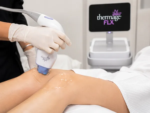 Thermage FLX on knees