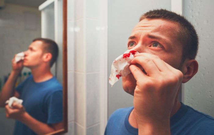 Indiana Sinus 5 Tips To Stop Nosebleeds Should I See An ENT