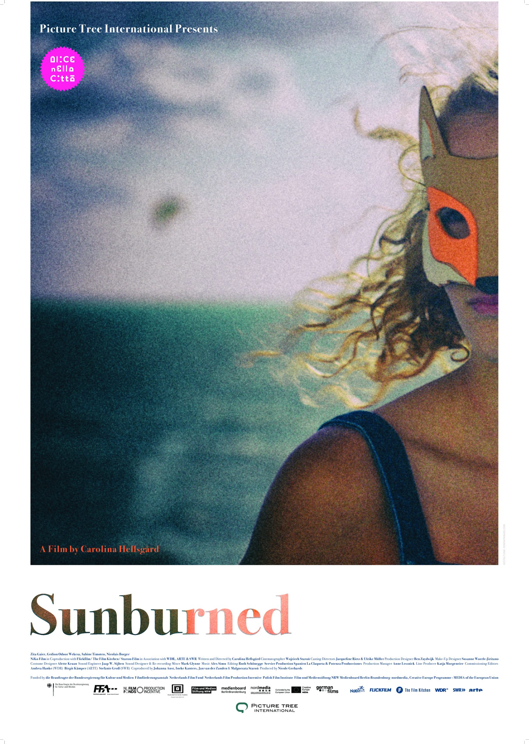 Sunburned