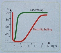 laserbehandling