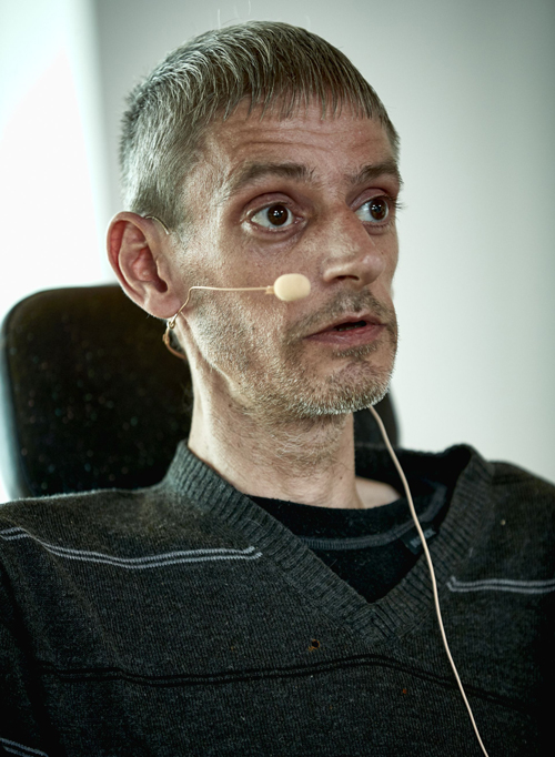 Muskelsvind er et fællesnavn for en række forskellige neuromuskulære.