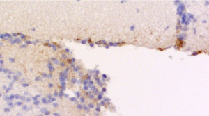 sdAb anti-SARS-CoV-2 Spike protein S1