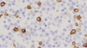 sdAb anti-SARS-CoV-2 Nucleocapsid