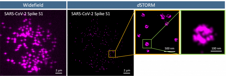 N3583_antiSARS_CoV_2_Spike_S1