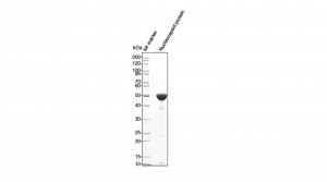 SARS-CoV-2 Nucleocapsid protein