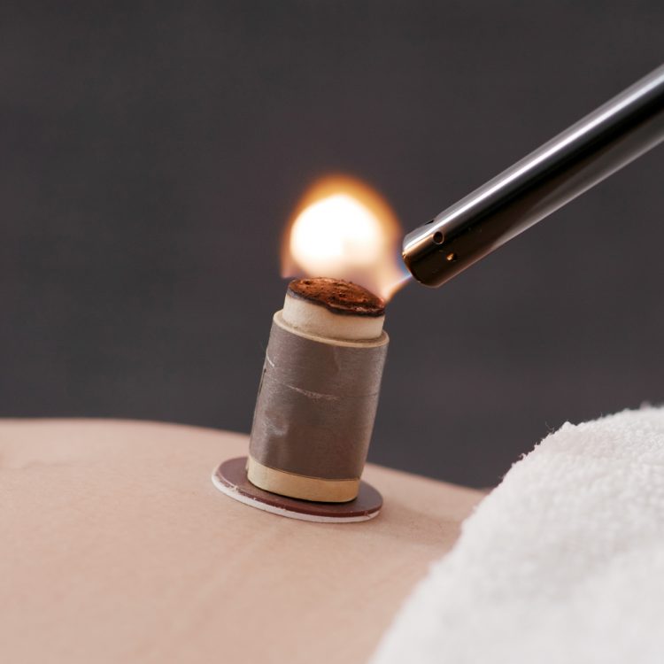 Herbal Zen Acupuncture Massage Herbal Remedies