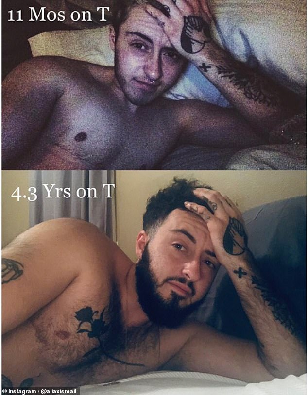 She took testosterone for six years - and it completely transformed the way she looked. She also surgically removed her breasts. She is pictured during her transition