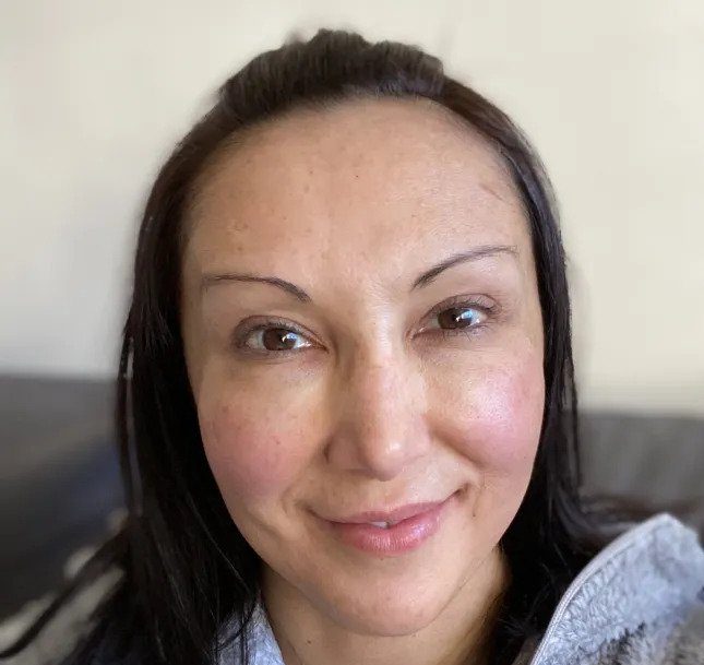 Nilufer Atik - My date apologised for his lateness, then his tooth fell out